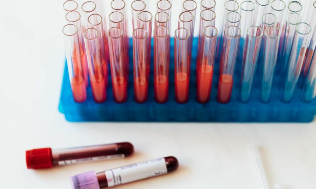 Combien de litres de sangs dans le corps humain