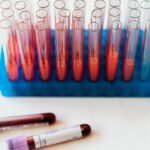 Combien de litres de sang avons-nous dans le corps humain ?